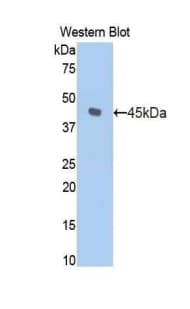 HK1 / Hexokinase 1 Antibody (aa413-540)