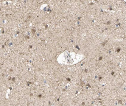 Polyclonal Rabbit anti-Human AURKA / Aurora-A Antibody (phospho-Thr288, IHC, IF, WB)