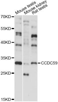 Polyclonal Rabbit anti-Human CCDC59 Antibody (WB)