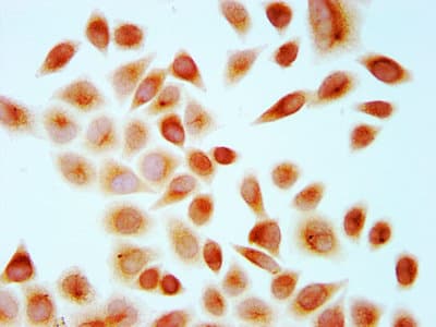 Polyclonal Rabbit anti-Human HIST1H4I Antibody (IHC)