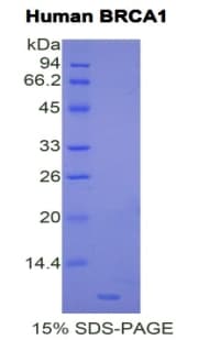 Human BRCA1 Protein (Recombinant His)