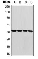 Polyclonal Rabbit anti-Human GDF1 Antibody (Internal, WB)