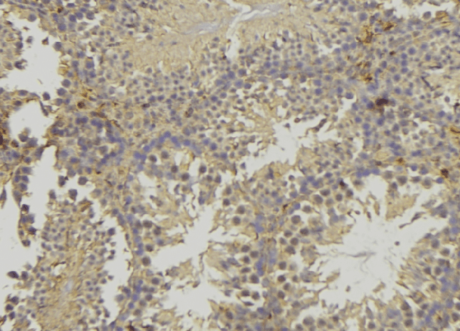 AQP2 / Aquaporin 2 Antibody