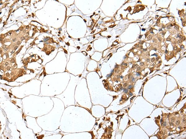 Polyclonal Rabbit anti-Human UBE2Z / USE1 Antibody (IHC, WB)