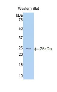 IL10RB Antibody (aa42-218, Cy3)