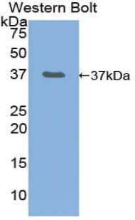 NF2 / Merlin Antibody (aa30-311, APC)