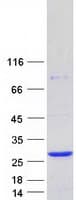 Human RAB22A / RAB22 Protein (Recombinant Myc-DDK (Flag))