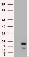 Monoclonal Mouse anti-Human RAB17 Antibody (clone OTI3A5, IHC, IF, WB)