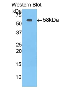 Polyclonal Rabbit anti-Human ABCB1 / MDR1 / P Glycoprotein Antibody (aa394-672, WB)