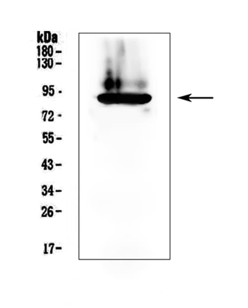 F2 / Prothrombin / Thrombin Antibody