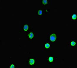 Polyclonal Rabbit anti-Human ASIP Antibody (IHC, IF)