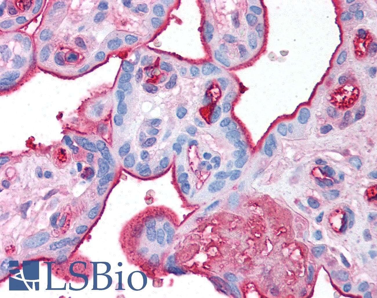 IHC-plus™ Polyclonal Rabbit anti-Human FN1 / Fibronectin Antibody (IHC, WB)