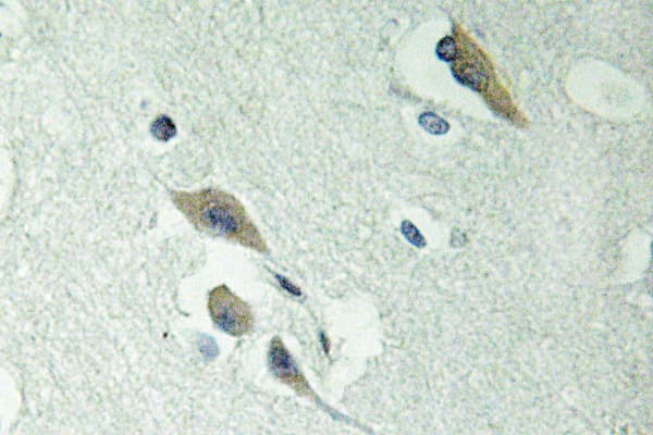 FAK / Focal Adhesion Kinase Antibody (Ile855)