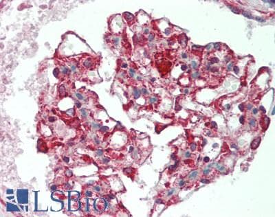 IHC-plus™ IL17RB Antibody