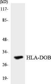 Polyclonal Rabbit anti-Human HLA-DOB Antibody (aa33-82, WB)