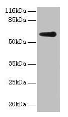 GK2 / Glycerol Kinase 2 Antibody (aa2-553)