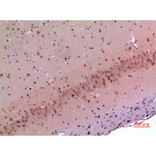 MANF / ARMET Antibody (1-50 aa, Internal)