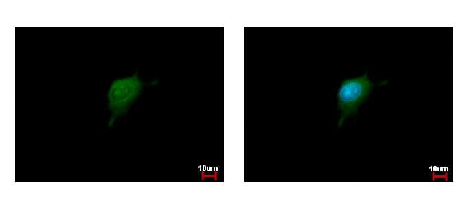 KPNA2 / Importin Alpha 1 Antibody (aa468-529)