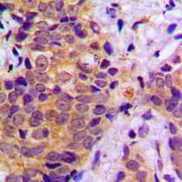Polyclonal Rabbit anti-Human BRAF / B-Raf Antibody (C-Terminus, IHC, WB)