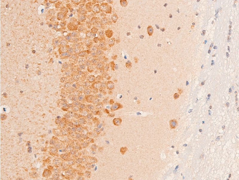 TGFB1 / TGF Beta 1 Antibody