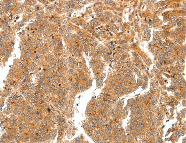 Secretin Antibody