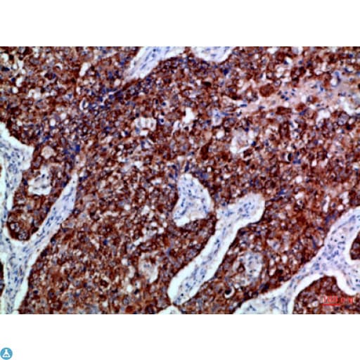 Polyclonal Rabbit anti-Human EPHB3 / EPH Receptor B3 Antibody (WB)