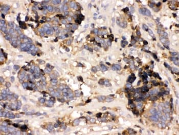 TTR / Transthyretin Antibody