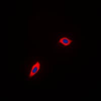 PEX11B Antibody (Internal)