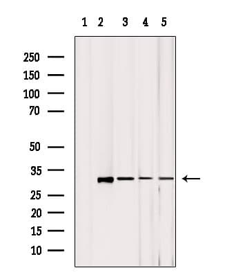 MRPL2 Antibody