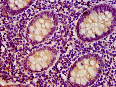 Polyclonal Rabbit anti-Human Rhodanese / TST Antibody (IHC, WB)