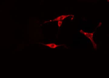 Polyclonal Rabbit anti-Human RPL18 / Ribosomal Protein L18 Antibody (IF, WB)