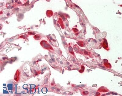IHC-plus™ HSPA5 / GRP78 / BiP Antibody (C-Terminus)