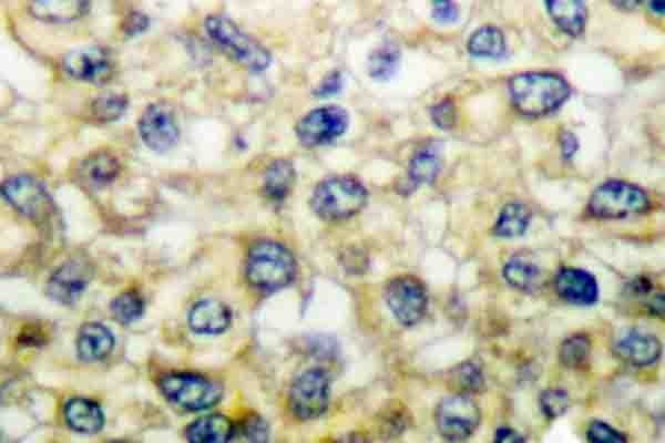 Polyclonal Rabbit anti-Human FGFR1OP / FOP Antibody (Asn371, IHC, IF, WB)