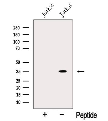 CRYM Antibody
