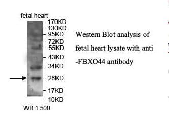FBXO44 Antibody (aa86-190)