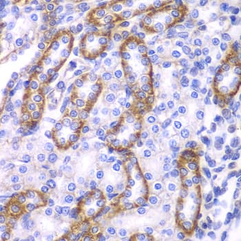Polyclonal Rabbit anti-Human ARRB1 / Beta Arrestin 1 Antibody (IHC, IF, WB)