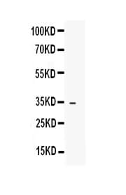 IGFBP1 Antibody