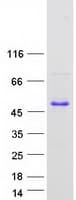 Human TEX264 Protein (Recombinant Myc-DDK (Flag))