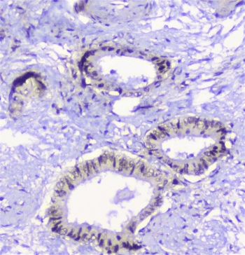 Properdin / CFP Antibody