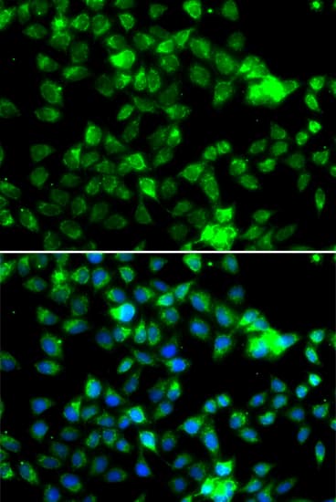 Polyclonal Rabbit anti-Human NAT5 / NAA20 Antibody (IHC, IF, WB)