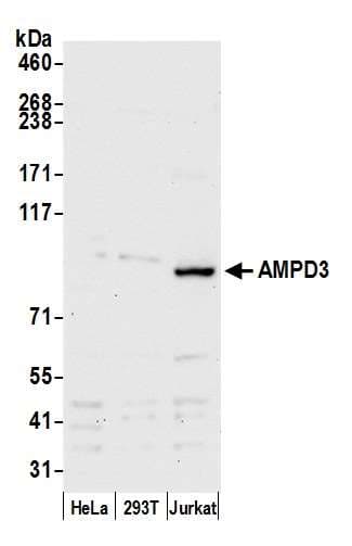 Polyclonal Rabbit anti-Human AMPD3 Antibody (aa1-50, WB)