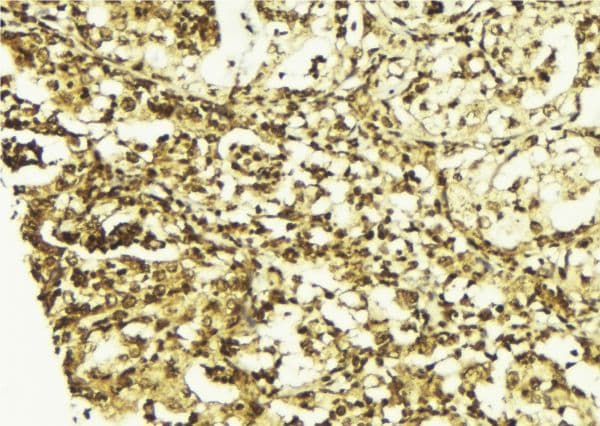 STAT5A Antibody (phospho-Ser725,pSer730)
