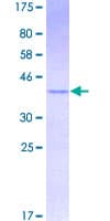 Human MGST2 Protein (Recombinant GST)