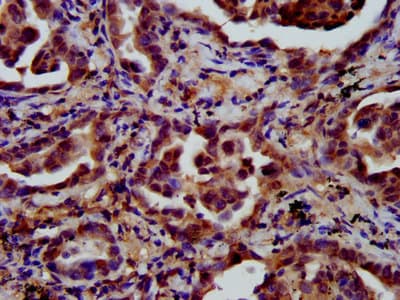 CD118 / LIF Receptor Alpha Antibody