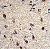 Polyclonal Rabbit anti-Human Dermatopontin / DPT Antibody (aa102-128, IHC, IF, WB)