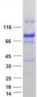 Human YAP / YAP1 Protein (Recombinant Myc-DDK (Flag))