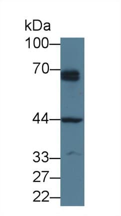 PTHR / PTHR1 Antibody (aa28-188)