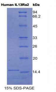 Human IL13RA2 / IL13R Alpha 2 Protein (Recombinant His)