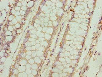 Polyclonal Rabbit anti-Human FSIP1 Antibody (IHC)