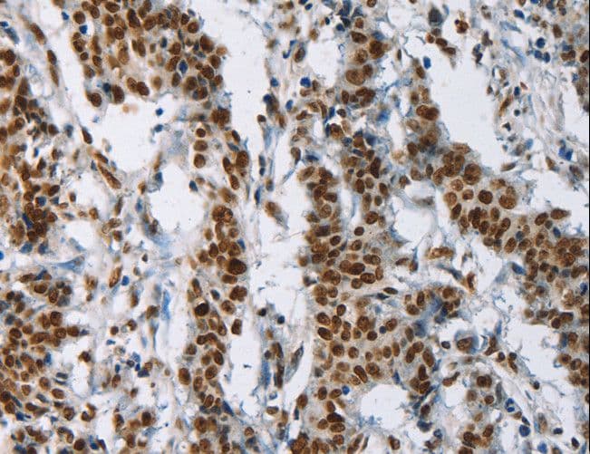 IL17C Antibody